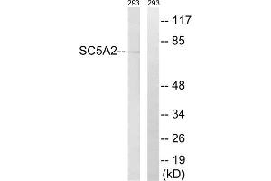 Western blot analysis of extracts from 293 cells, using SLC5A2 antibody. (SLC5A2 anticorps  (Internal Region))