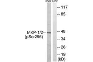 Western blot analysis of extracts from K562 cells treated with heat shock , using MKP-1/2 (Phospho-Ser296/318) Antibody. (MKP-1/2 anticorps  (pSer296))