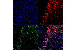 Immunocytochemistry/Immunofluorescence analysis using Mouse Anti-Alpha Synuclein Monoclonal Antibody, Clone 3F8 (ABIN5564089). (SNCA anticorps)