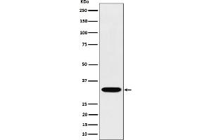Western blot analysis of TSFM expression in Jurkat cell lysate.