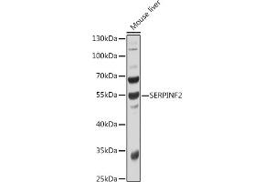 Western blot analysis of extracts of Mouse liver, using SERPINF2 antibody  at 1:1000 dilution.