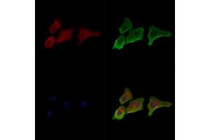 Phospho-Mitofusin 2 (Ser442) Antibody staining HepG2 cells(serum starvation treatment) by IF/ICC. (MFN2 anticorps  (pSer442))
