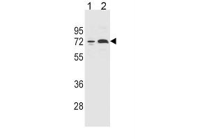 Western Blotting (WB) image for anti-Cytochrome P450, Family 2, Subfamily B, Polypeptide 6 (CYP2B6) antibody (ABIN2996016) (CYP2B6 anticorps)