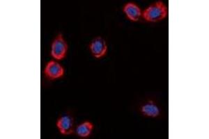 Immunofluorescent analysis of GPR87 staining in HuvEc cells.