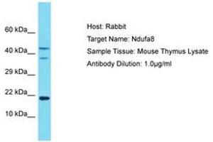 Image no. 1 for anti-NADH Dehydrogenase (Ubiquinone) 1 alpha Subcomplex, 8, 19kDa (NDUFA8) (AA 41-90) antibody (ABIN6749906)
