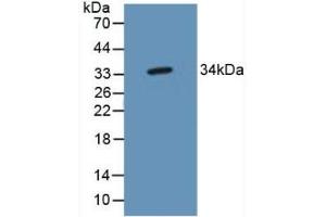 Detection of TP53TG5 in Mouse Brain Tissue using Polyclonal Antibody to TP53 Target Gene 5 (TP53TG5) (TP53TG5 anticorps  (AA 190-262))