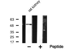 Western blot analysis of hnRNP H expression in rat kidney lysate (HNRNPH1 anticorps  (Internal Region))