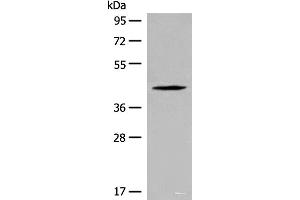 Western blot analysis of Jurkat cell lysate using QTRT1 Polyclonal Antibody at dilution of 1:450 (QTRT1 anticorps)