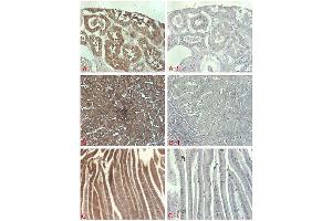 Immunohistochemical staining of of human tissue using anti-DLL1 (human), pAb  at 1:500 dilution. (DLL1 anticorps)