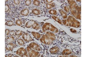 Immunoperoxidase of monoclonal antibody to MAN1B1 on formalin-fixed paraffin-embedded human stomach.