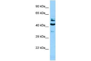 WB Suggested Anti-SH2D4A Antibody Titration: 1. (SH2D4A anticorps  (N-Term))