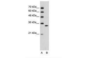 Image no. 2 for anti-Ribonuclease H2, Subunit A (RNASEH2A) (C-Term) antibody (ABIN6736313) (RNASEH2A anticorps  (C-Term))