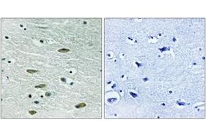 Immunohistochemistry analysis of paraffin-embedded human brain tissue, using IGF1R (Ab-1346) Antibody.