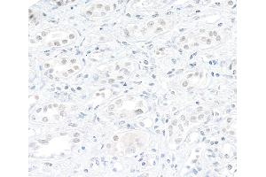 Immunohistochemistry (IHC) image for anti-ATP-Dependent RNA Helicase A (DHX9) (AA 200-250) antibody (ABIN7454523)