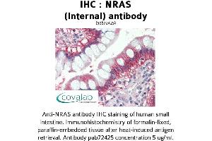 Image no. 1 for anti-GTPase NRas (NRAS) (Internal Region) antibody (ABIN1737523) (GTPase NRas anticorps  (Internal Region))