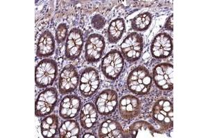 Immunohistochemical staining of human colon with TMC5 polyclonal antibody  shows moderate cytoplasmic, membranous and nuclear positivity in glandular cells at 1:50-1:200 dilution. (Tmc5 anticorps)