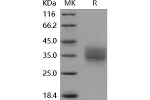 Western Blotting (WB) image for Frizzled Family Receptor 1 (Fzd1) protein (His tag) (ABIN7195855)