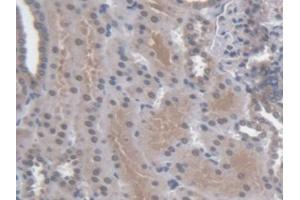 DAB staining on IHC-P; Samples: Human Kidney Tissue (Regucalcin anticorps  (AA 65-299))