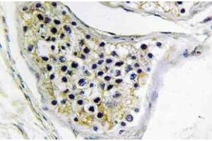 Immunohistochemistry (IHC) analyzes of CNOT4 antibody in paraffin-embedded human testis tissue. (CNOT4 anticorps)