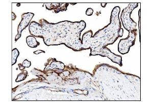 IHC analysis of CD39/ENTPD1 using anti-CD39/ENTPD1 antibody (ABIN7602461).
