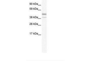 Image no. 1 for anti-Estrogen-Related Receptor beta (ESRRB) (N-Term) antibody (ABIN6735991) (ESRRB anticorps  (N-Term))