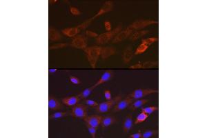 Immunofluorescence analysis of NIH-3T3 cells using T Rabbit mAb (ABIN7270916) at dilution of 1:100 (40x lens).