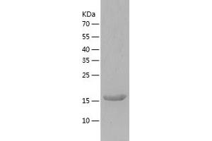 Western Blotting (WB) image for Regulator of Calcineurin 2 (RCAN2) (AA 1-197) protein (His-IF2DI Tag) (ABIN7124811)