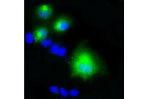 Anti-LIPG mouse monoclonal antibody (ABIN2453255) immunofluorescent staining of COS7 cells transiently transfected by pCMV6-ENTRY LIPG (RC209248). (LIPG anticorps)