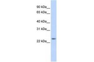 Image no. 1 for anti-RAB8A, Member RAS Oncogene Family (RAB8A) (C-Term) antibody (ABIN6741500)