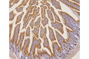 IHC analysis of PYROXD1 using anti-PYROXD1 antibody (ABIN6719650). (PYROXD1 anticorps  (AA 48-230))