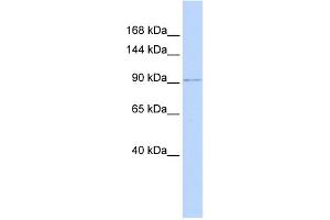 WB Suggested Anti-NDST3 Antibody Titration:  0.