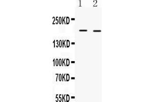 Western blot analysis of Collagen I expression in mouse kidney extract ( Lane 1) and mouse cardiac muscle extract ( Lane 2). (COL1A1 anticorps  (C-Term))