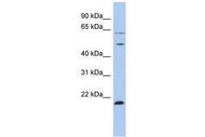 Image no. 1 for anti-Proteasome (Prosome, Macropain) 26S Subunit, ATPase, 2 (PSMC2) (N-Term) antibody (ABIN6742450) (PSMC2 anticorps  (N-Term))