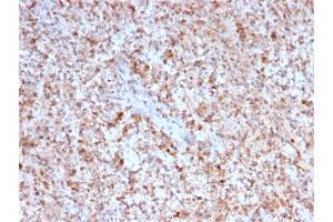 Formalin-fixed, paraffin-embedded human Spleen stained with CD40 Ligand Mouse Monoclonal Antibody (CD40LG/2763). (CD40 Ligand anticorps  (AA 108-261))