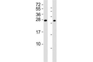 Western blot testing of RHOXF1 antibody at 1:2000; Lane 1: A2058 cell lysate, Lane 2: human ovary lysate. (RHOXF1 anticorps  (AA 85-120))