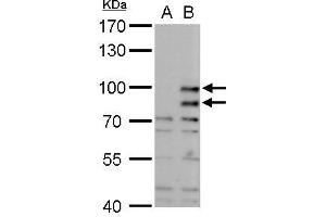 WB Image MDM2 antibody detects MDM2 protein by western blot analysis. (MDM2 anticorps  (Center))