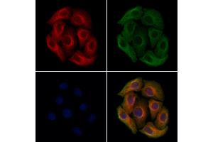 ABIN7094644 and ABIN7098694 staining Hela cells by IF/ICC. (Plastin 3 anticorps  (Internal Region))