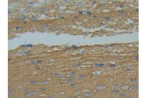 IHC-P analysis of Rat Brain Tissue, with DAB staining. (GAP43 anticorps  (AA 8-226))