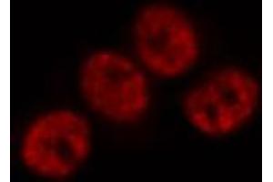 ABIN6269171 staining Hela by IF/ICC. (JunD anticorps)