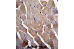 VILL Antibody (Center) (ABIN656022 and ABIN2845397) immunohistochemistry analysis in formalin fixed and paraffin embedded human skeletal muscle followed by peroxidase conjugation of the secondary antibody and DAB staining.