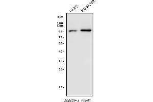 Western blot analysis of PDE6 beta/PDE6B using anti-PDE6 beta/PDE6B antibody (ABIN7600894).