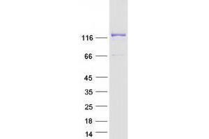 Validation with Western Blot