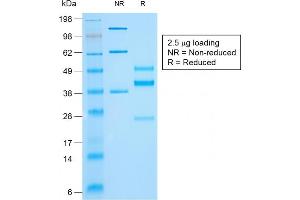 SDS-PAGE Analysis of Purified Cytokeratin 10 Mouse Recombinant Monoclonal Antibody (rKRT10/844). (Recombinant Keratin 10 anticorps)