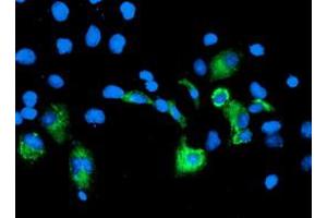 Image no. 3 for anti-Carboxypeptidase A2 (Pancreatic) (CPA2) antibody (ABIN1497594) (Carboxypeptidase A2 anticorps)