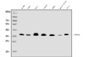 Western blot analysis of TRAP/CD40L/CD40LG using anti-TRAP/CD40L/CD40LG antibody (ABIN7602423).