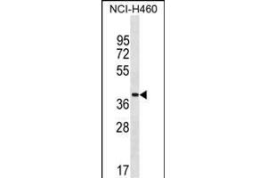 ZN Antibody (Center) (ABIN1537874 and ABIN2849918) western blot analysis in NCI- cell line lysates (35 μg/lane). (ZNF488 anticorps  (AA 149-175))