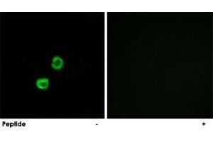 Immunofluorescence analysis of MCF-7 cells, using GCNT7 polyclonal antibody .
