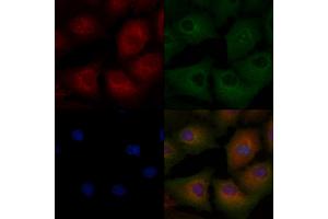 ABIN6265163 and ABIN6272472 staining  cells by IF/ICC. (Transgelin anticorps  (C-Term))