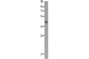 Western Blotting (WB) image for anti-Melanocortin 5 Receptor (MC5R) antibody (ABIN2431634) (MC5 Receptor anticorps)
