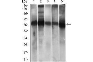 Western blot analysis using ALDH2 mouse mAb against HepG2 (1), A549 (2) cell lysate, and Rat live (3), Mouse liver (4), Mouse brain (5) tissue lysate. (ALDH2 anticorps  (AA 317-517))